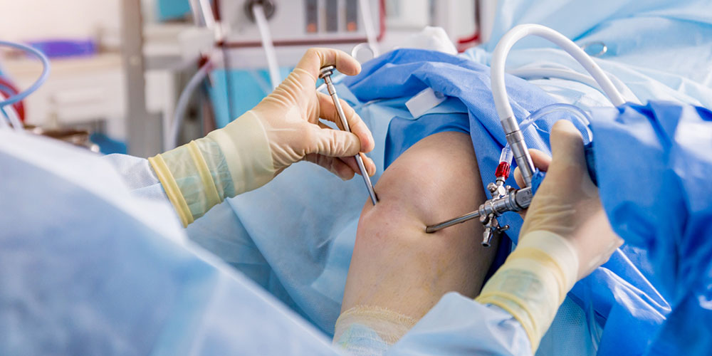 Arthroscopy