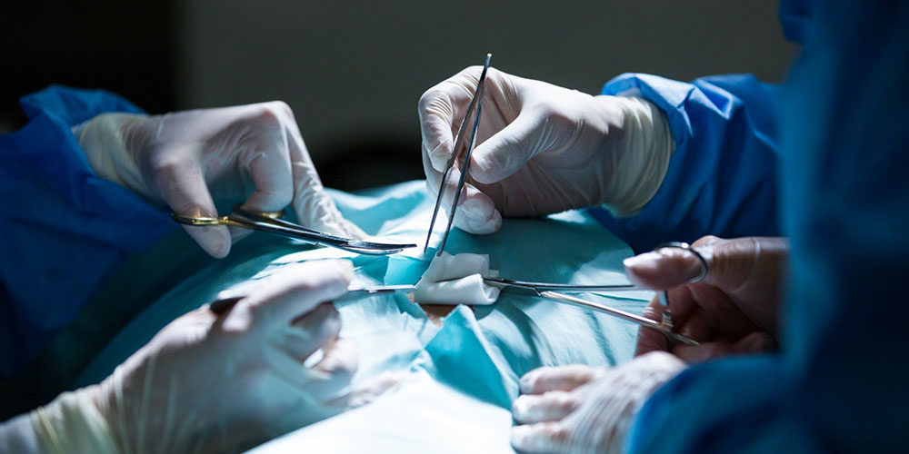 Laparoscopic Surgery